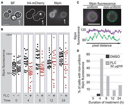 Colony and Single Cell Level Analysis of the Heterogeneous Response of Cryptococcus neoformans to Fluconazole